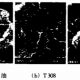 Figure 3 Surface pitting of GCr15 bearing steel ball in microgram